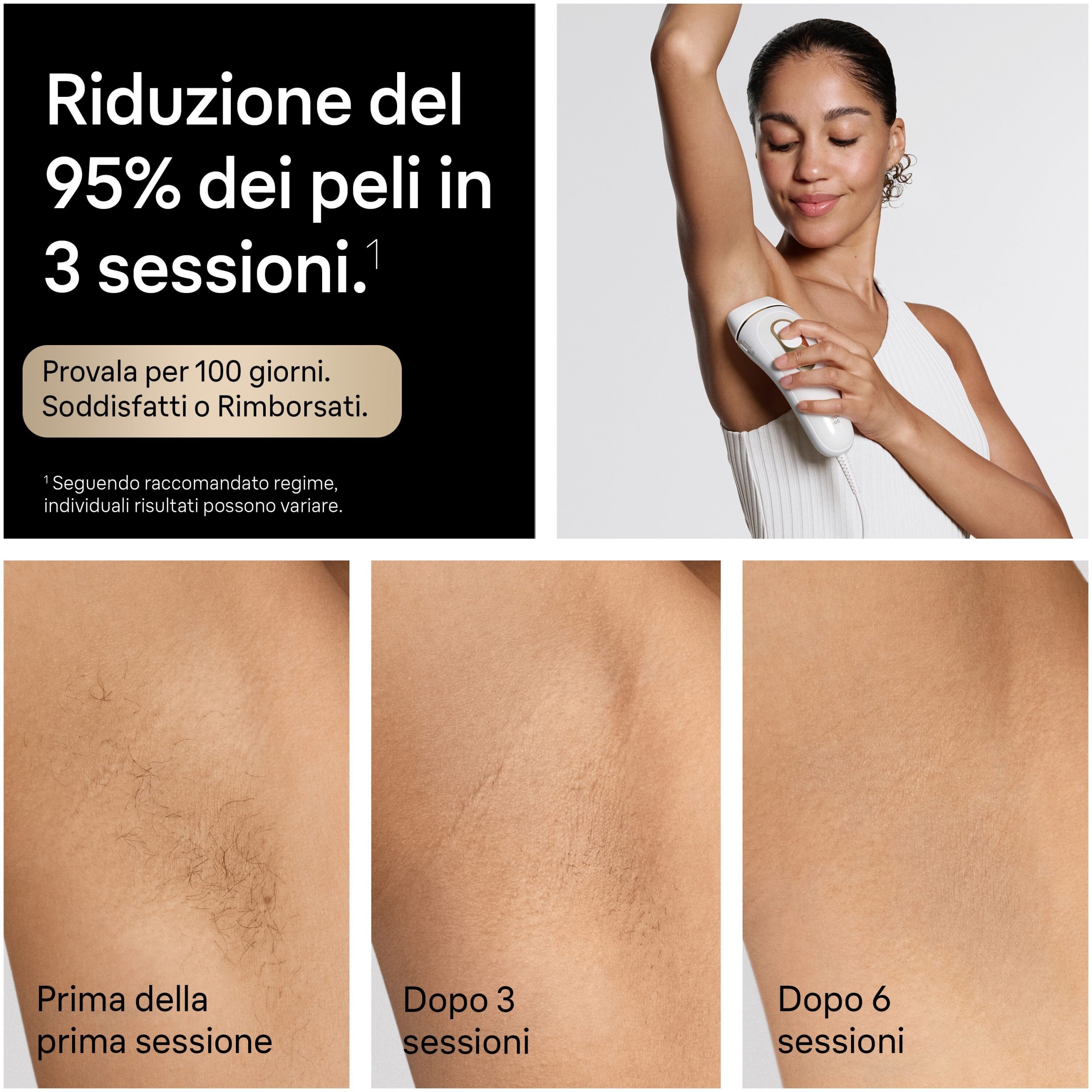 BRAUN PL5210 Epilatore Luce Pulsata IPL SmartFlex con Custodia - immagine 2